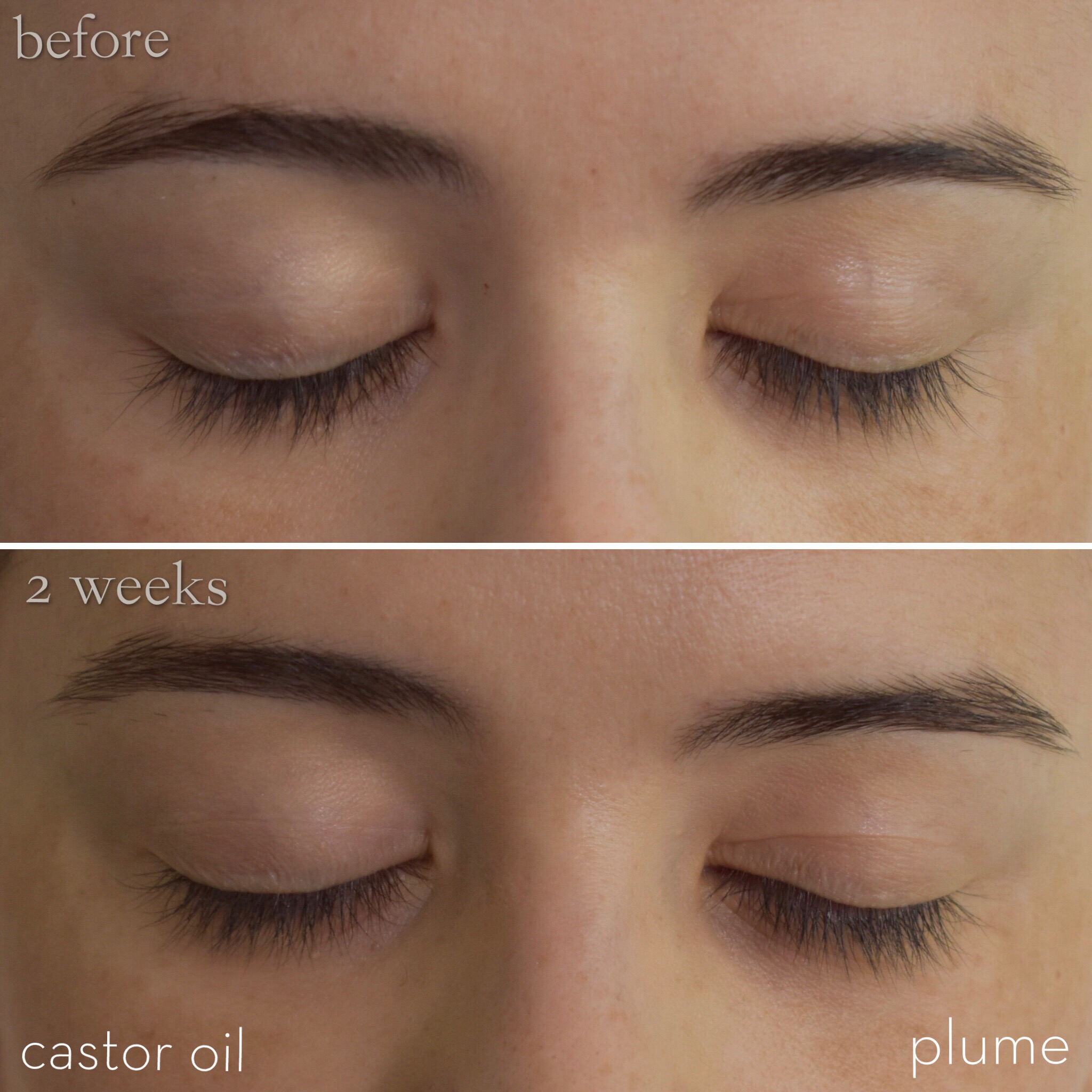 does-castor-oil-help-eyelashes-grow-examples-and-forms